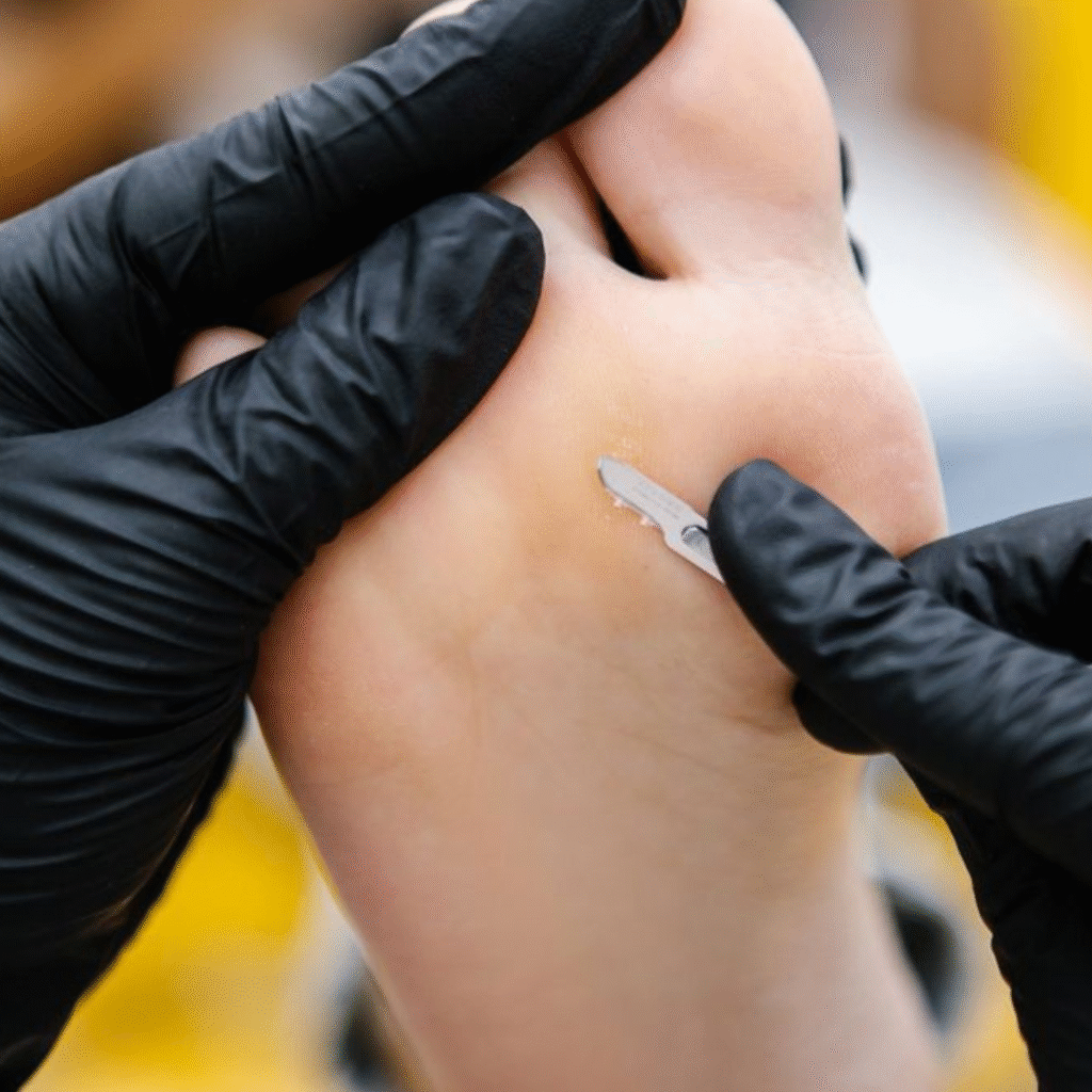 servicios de podología Orihuela