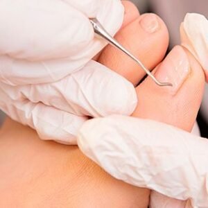 Pack de Quiropodia Profesional + Consulta de Cuidado Básico del Pie